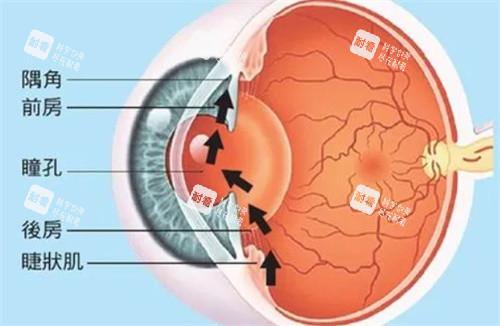 青光眼眼压高的原因