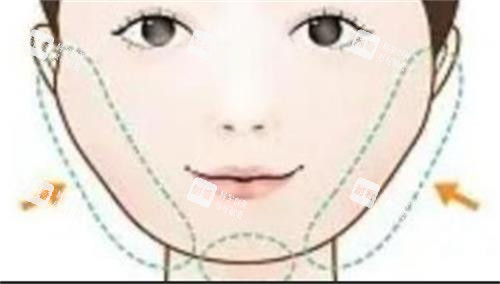 磨骨手术的部位