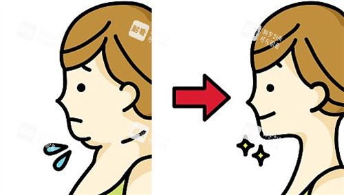 双下巴提升前后对比卡通