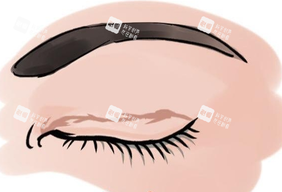 眼角增生疤痕动画展示图 眼角增生疤痕动画展示图