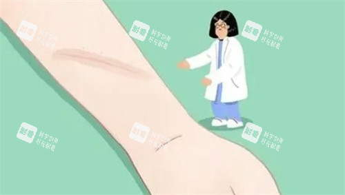 疤痕卡通图 疤痕卡通图