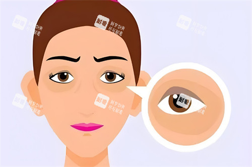 中年眼袋 中年眼袋