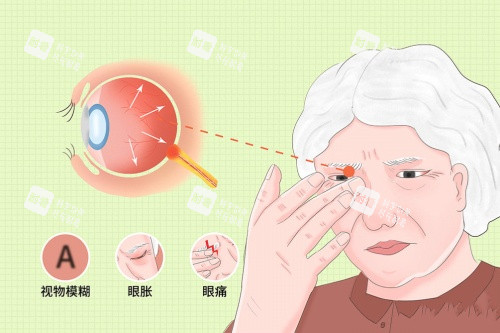视神经萎缩卡通展示图