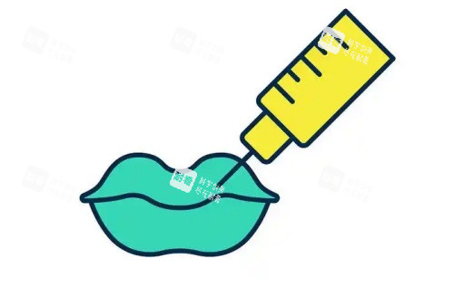 丰唇注射示意图