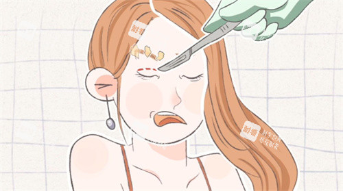 双眼皮手术失败修复卡通图片