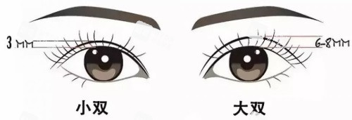 双眼皮宽度示意图