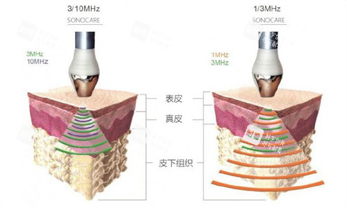 LDM水滴提升原理