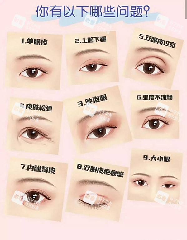 双眼皮类型图片