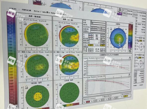东莞友华普惠眼科近视改善