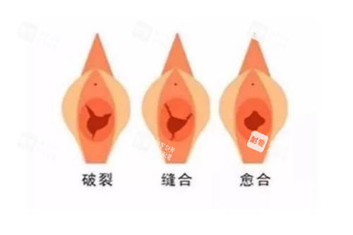 私密整形治疗图片展示