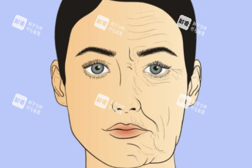 面部衰老提升卡通对比图