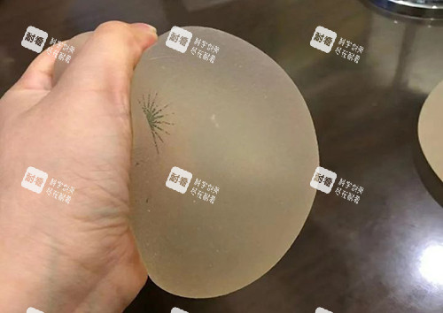 丰胸手术傲诺拉璀璨揉捏展示图