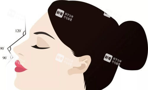 深圳张辉医生鼻整形怎么样？赫本鼻打造专长+骨感美感风格实例实测