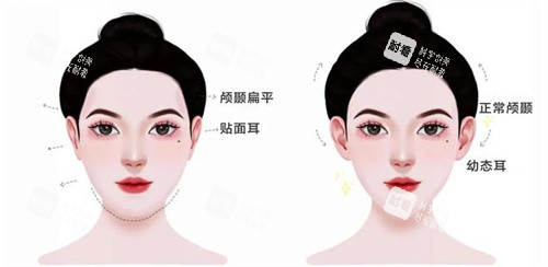 幼态脸主要做的项目