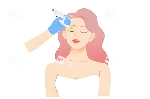 热玛吉操作图片