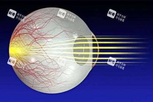 视网膜色素变性卡通图