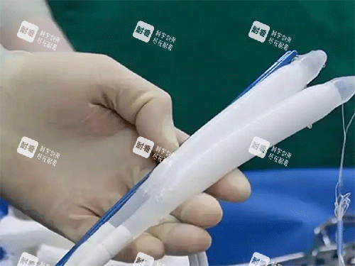 男性三件套假体照片 男性三件套假体照片