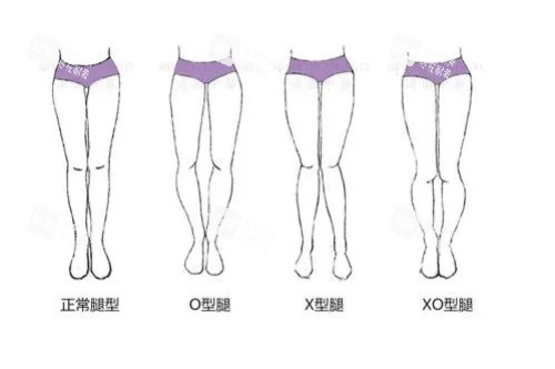 各种腿型卡通图