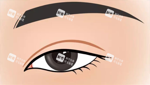 双眼皮形态展示