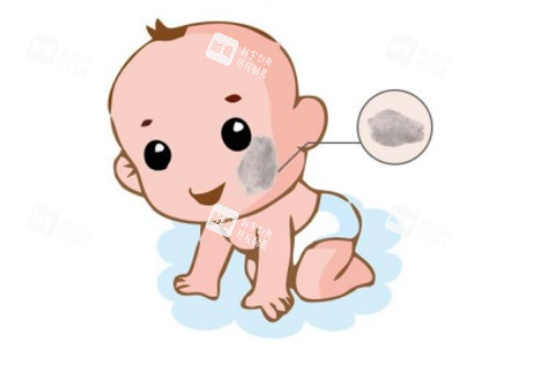 脸上胎记卡通图