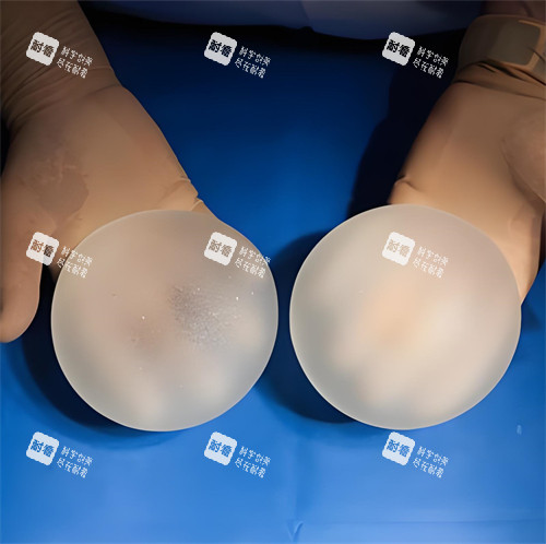 隆胸手术硅胶假体图