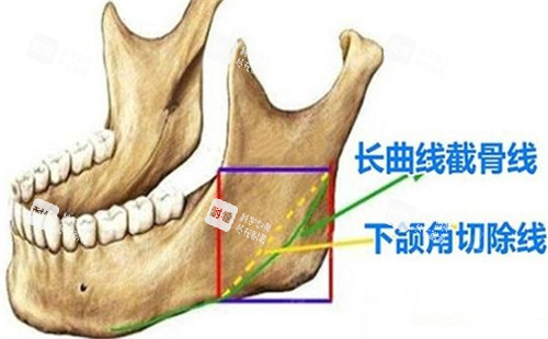 下颌角所在位置