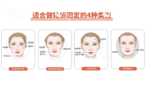面部轮廓固定适合类型