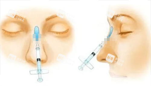 玻尿酸注射隆鼻动画展示图