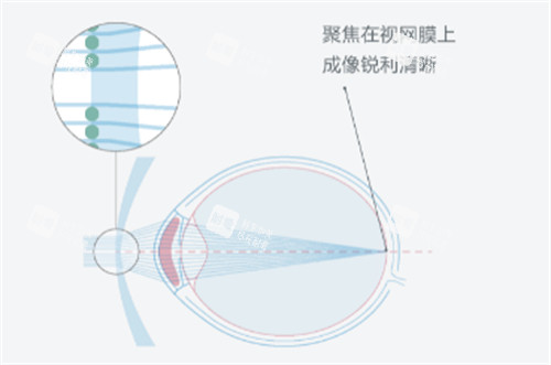 依视路星趣控镜片的优势图解