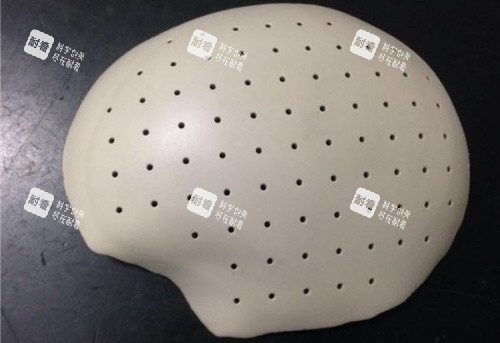 PEEK材料填充颅骨示意图