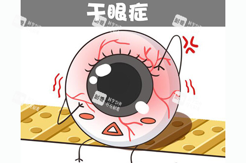 干眼症卡通图展示 干眼症卡通图展示