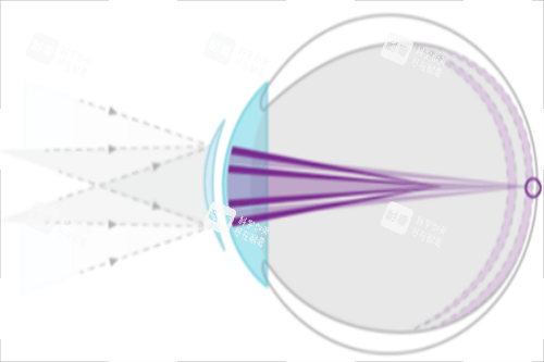 离焦镜片光线示意图 离焦镜片光线示意图