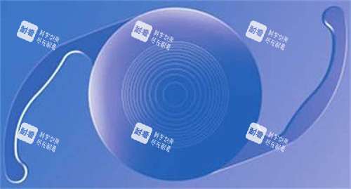 白内障晶体示意图展示