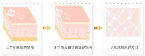 胶原蛋白工作原理