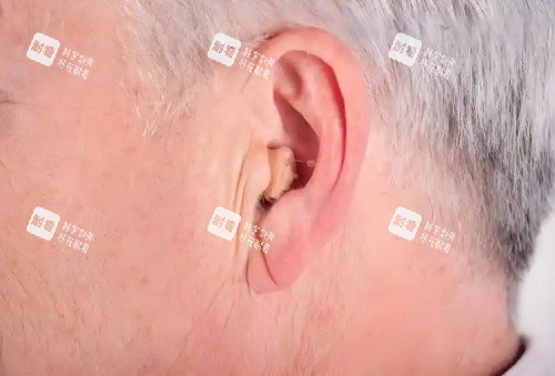 耳基底松弛示意图