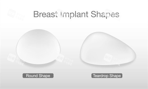圆形和水滴形隆胸假体
