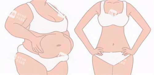 激光溶脂瘦腰腹对比图 激光溶脂瘦腰腹对比图