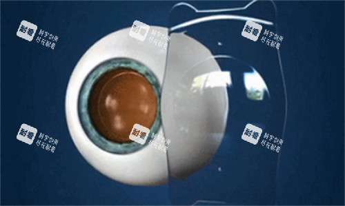 人工晶体的样子