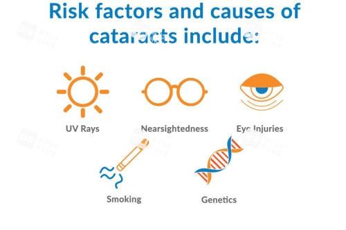 白内障病因 白内障病因
