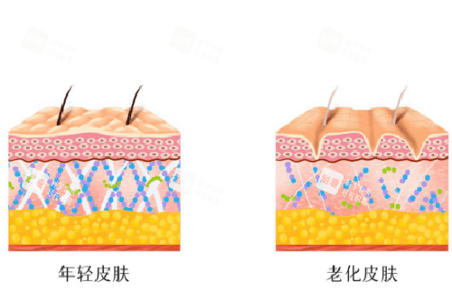 平滑皮肤和有皱纹皮肤示意图