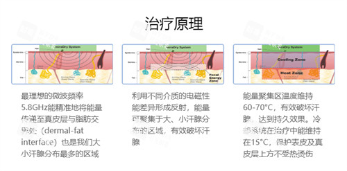 清新微波去腋臭技术原理图解