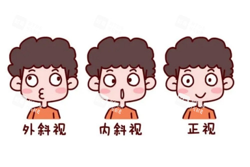眼睛内斜视外斜视正常眼睛对比图