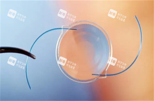 白内障人工晶体