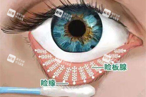 眼睛睑缘和睑板腺漫画图