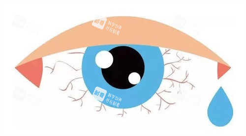 眼睛干涩