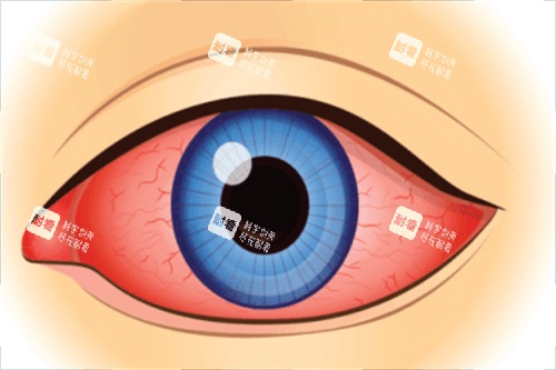 眼睛通红
