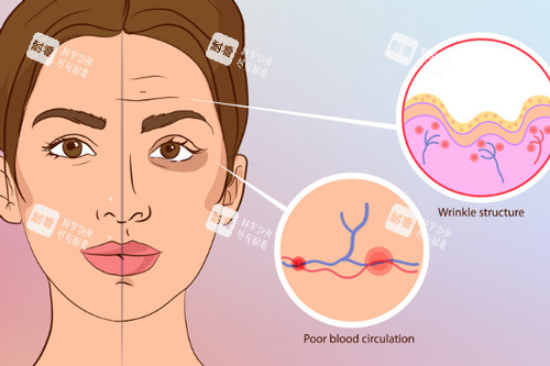 注射玻尿酸前后对比
