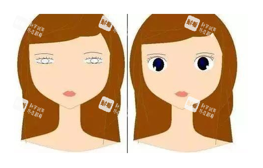眼皮松弛做双眼皮对比图