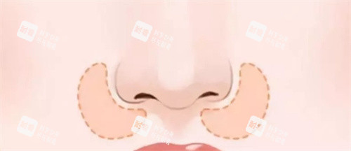 鼻基底鼻部展示图