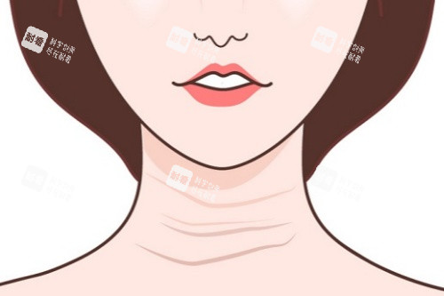 颈纹卡通图片展示 颈纹卡通图片展示